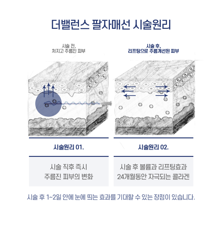 hotspot image