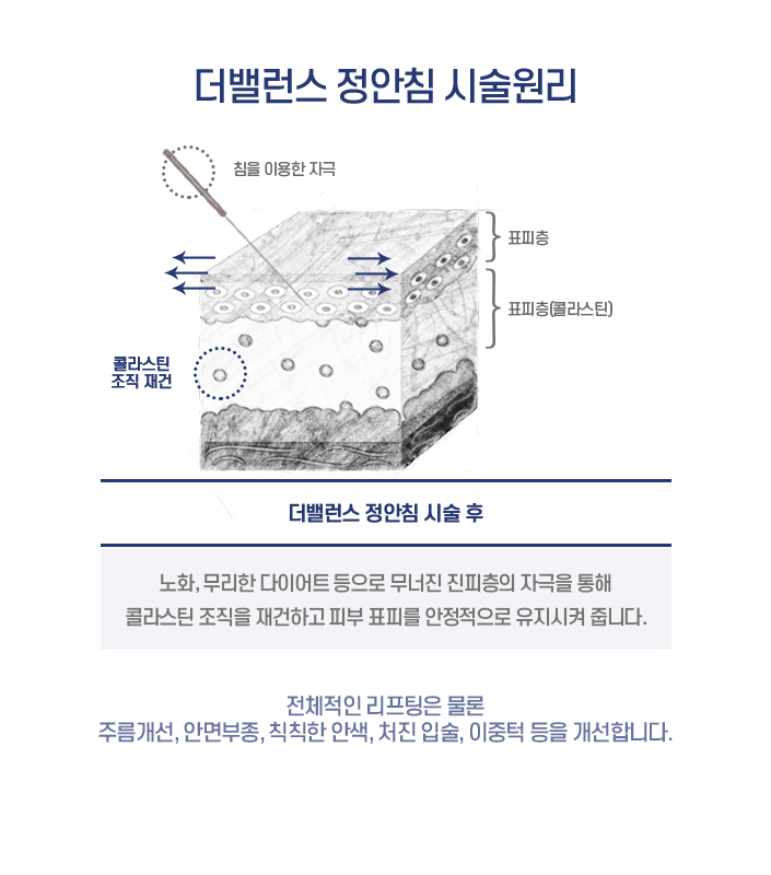 hotspot image