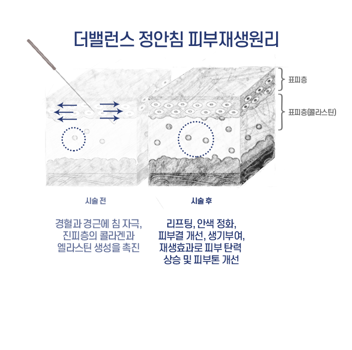 hotspot image