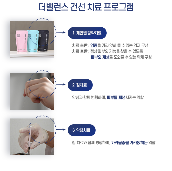 hotspot image